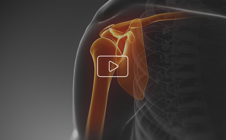 Patient Education Videos