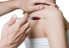 Platelet-Rich Plasma (PRP) Injection